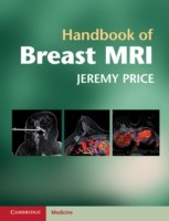 EBOOK Handbook of Breast MRI