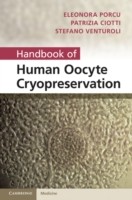 EBOOK Handbook of Human Oocyte Cryopreservation