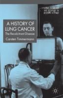 EBOOK History of Lung Cancer