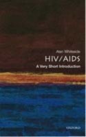 EBOOK HIV/AIDS