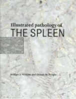 EBOOK Illustrated Pathology of the Spleen