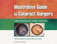 EBOOK Illustrative Guide to Cataract Surgery