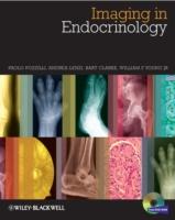 EBOOK Imaging in Endocrinology