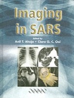 EBOOK Imaging in SARS