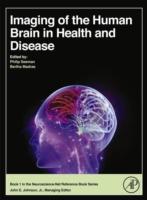 EBOOK Imaging of the Human Brain in Health and Disease