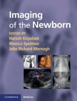 EBOOK Imaging of the Newborn