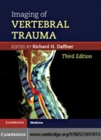 EBOOK Imaging of Vertebral Trauma