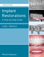 EBOOK Implant Restorations
