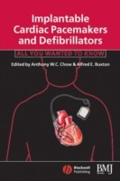 EBOOK Implantable Cardiac Pacemakers and Defibrillators