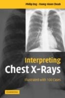 EBOOK Interpreting Chest X-Rays