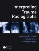 EBOOK Interpreting Trauma Radiographs