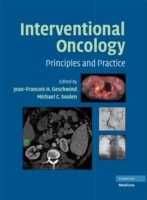 EBOOK Interventional Oncology