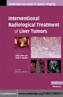 EBOOK Interventional Radiological Treatment of Liver Tumors