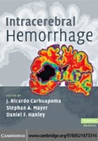 EBOOK Intracerebral Hemorrhage
