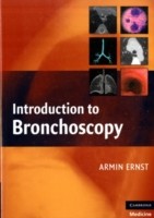 EBOOK Introduction to Bronchoscopy