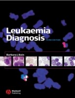EBOOK Leukaemia Diagnosis