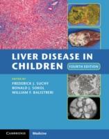 EBOOK Liver Disease in Children
