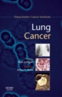 EBOOK Lung Cancer