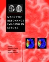 EBOOK Magnetic Resonance Imaging in Stroke