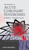 EBOOK Management of Acute Coronary Syndromes