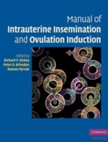 EBOOK Manual of Intrauterine Insemination and Ovulation Induction