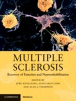 EBOOK Multiple Sclerosis