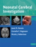 EBOOK Neonatal Cerebral Investigation