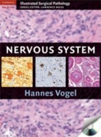 EBOOK Nervous System