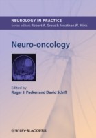 EBOOK Neuro-oncology