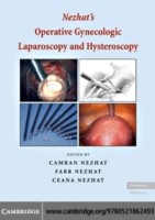 EBOOK Nezhat's Operative Gynecologic Laparoscopy and Hysteroscopy