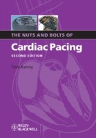EBOOK Nuts and Bolts of Cardiac Pacing