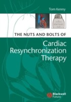 EBOOK Nuts and Bolts of Cardiac Resynchronization Therapy