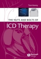 EBOOK Nuts and Bolts of ICD Therapy