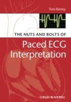 EBOOK Nuts and bolts of Paced ECG Interpretation