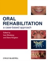 EBOOK Oral Rehabilitation