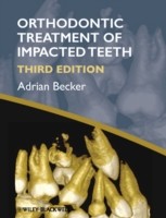 EBOOK Orthodontic Treatment of Impacted Teeth
