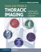 EBOOK Pearls and Pitfalls in Thoracic Imaging