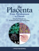 EBOOK Placenta