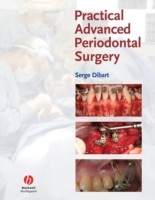 EBOOK Practical Advanced Periodontal Surgery