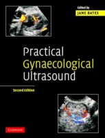 EBOOK Practical Gynaecological Ultrasound