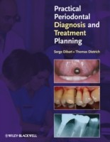 EBOOK Practical Periodontal Diagnosis and Treatment Planning