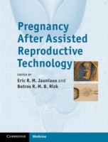 EBOOK Pregnancy After Assisted Reproductive Technology