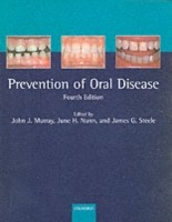 EBOOK Prevention of Oral Disease