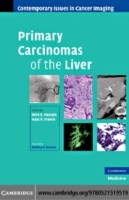 EBOOK Primary Carcinomas of the Liver
