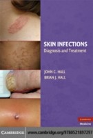 EBOOK Skin Infections