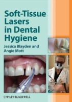 EBOOK Soft-Tissue Lasers in Dental Hygiene