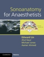EBOOK Sonoanatomy for Anaesthetists