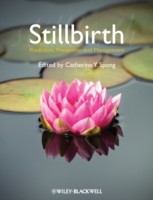 EBOOK Stillbirth