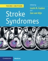 EBOOK Stroke Syndromes