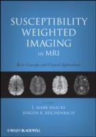 EBOOK Susceptibility Weighted Imaging in MRI
